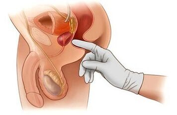 Prostata di maschera