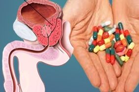 farmaci per il trattamento della prostatite