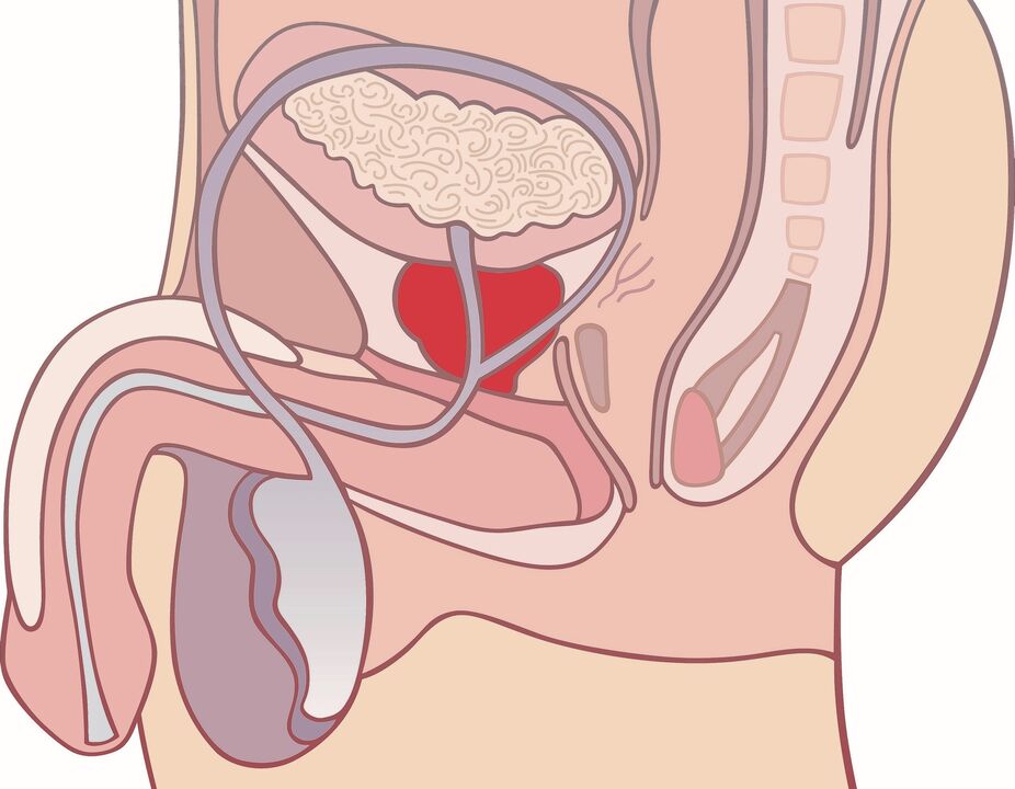 prostata infiammata con prostatite